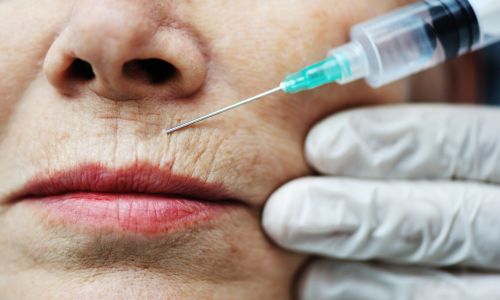 botox cost in bhubaneswar